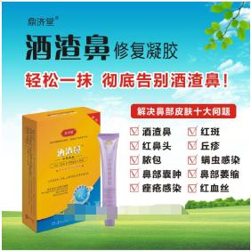 酒渣鼻修復凝膠OEM代工